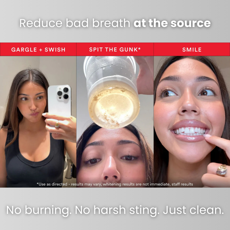 ID™ Stain Mouthwash