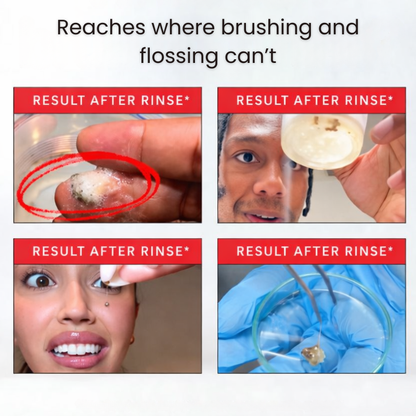 ID™ Stain Mouthwash