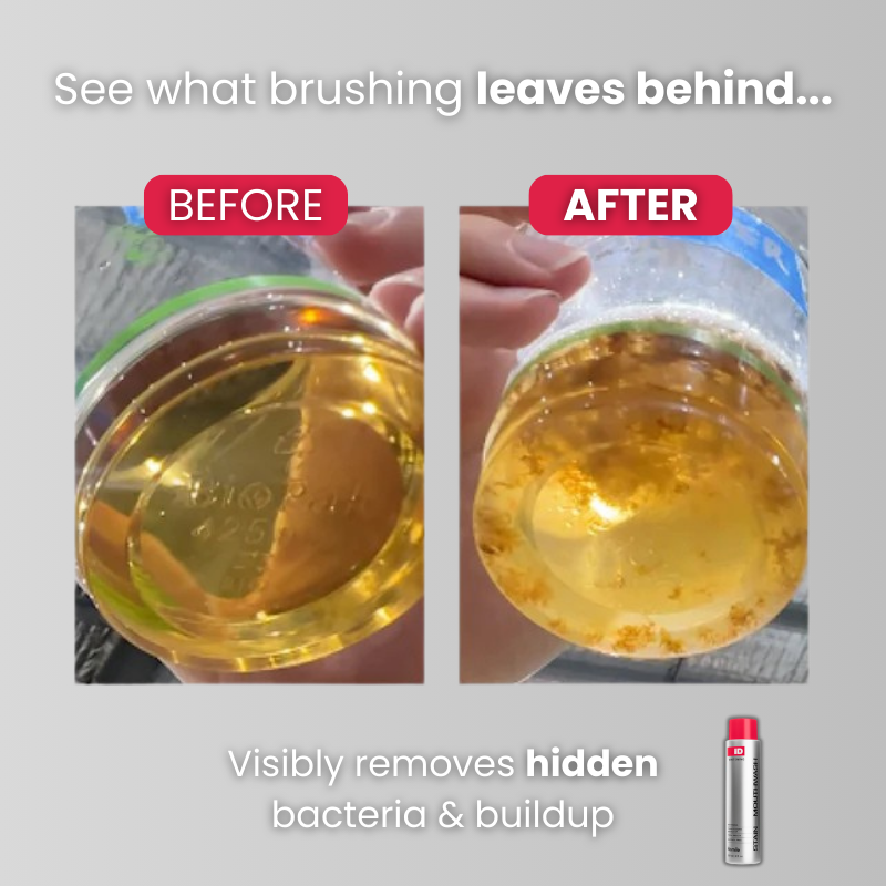 ID™ Stain Mouthwash